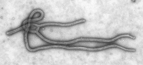 Ebola virus disease (EVD) under an electron microscope